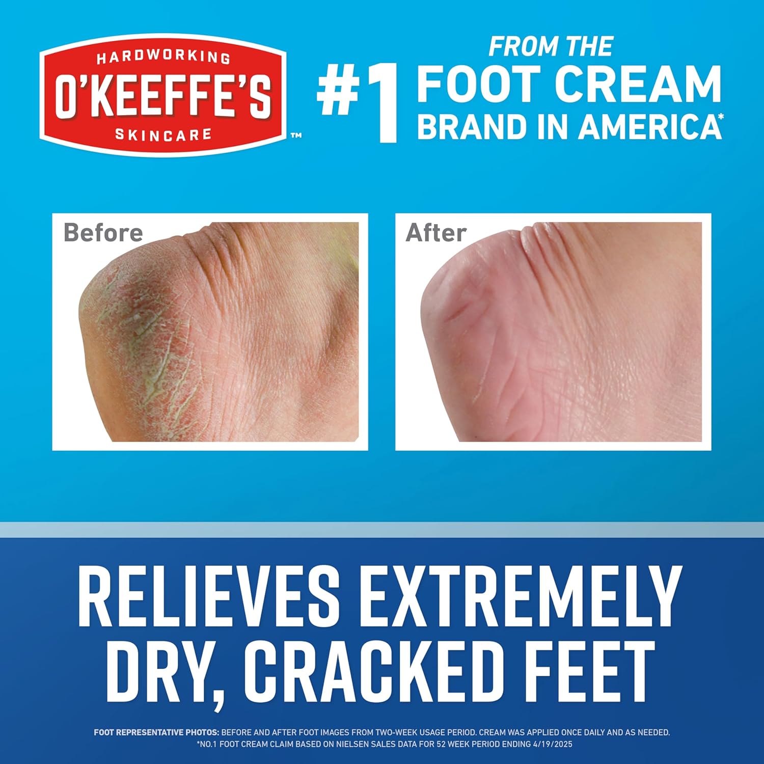 O'Keeffe's Healthy Feet Cream - (1 Pack) - Guaranteed Relief for Extremely Cracked & Dry Feet (special limited product)